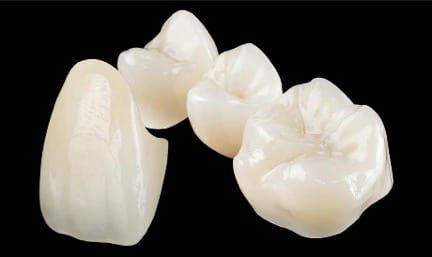 Ceramic Crowns