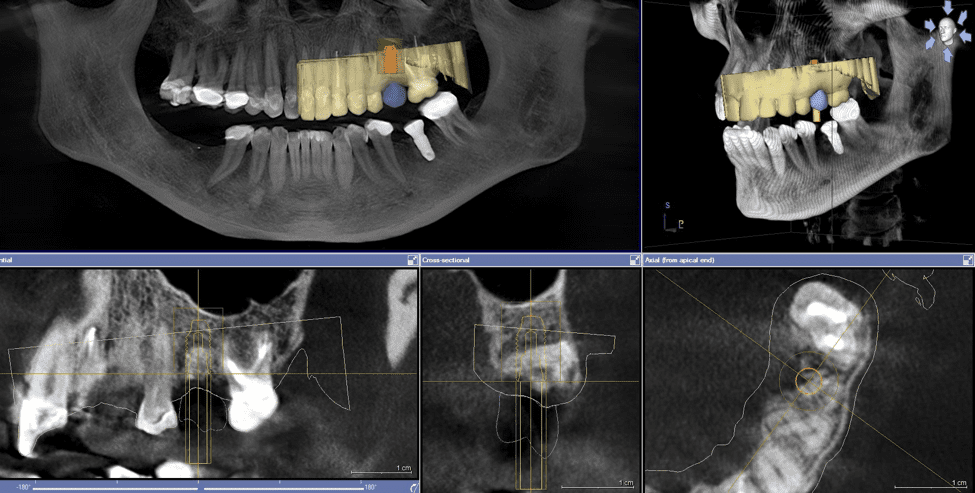 Dental Cone Beam Computed Tomography 2