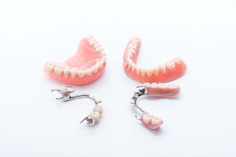 Set of dentures on white background Hybrid and fixed dentures