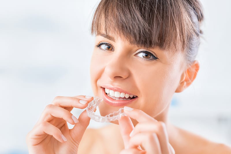 Invisalign services