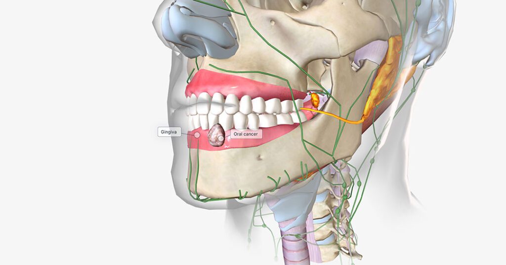 ​​Our experienced dentists, hygienists, and staff at Midtown Dental can identify potentially dangerous growths in your mouth.​