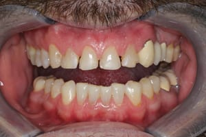 Unhealthy Teeth Before Cosmetic Dentistry - Open Mouth