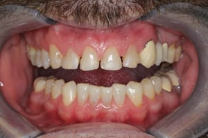 Unhealthy Teeth Before Cosmetic Dentistry - Open Mouth Unhealthy Teeth Before Cosmetic Dentistry - Open Mouth
