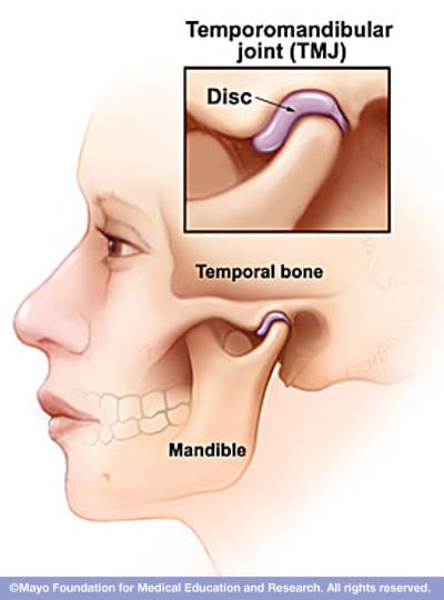 TMJ bone and joint view