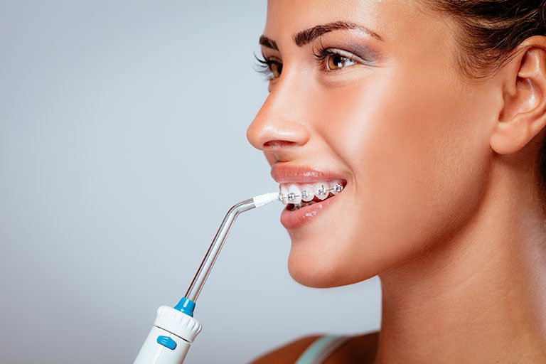 A young woman uses a Waterpik water flosser to clean plaque and food particles behind her braces brackets and along her gums.